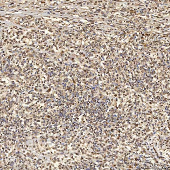 Anti-SNRNP27 Antibody