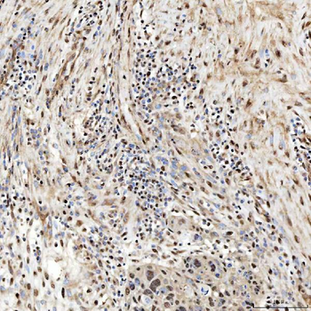 Anti-SNRNP27 Antibody