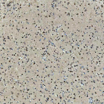 Anti-SNRNP27 Antibody