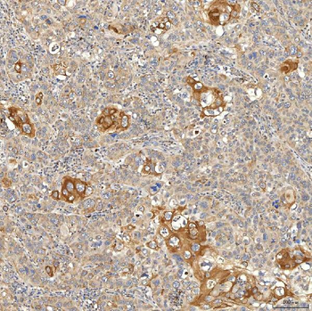 Anti-SNPH Antibody
