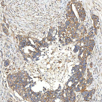 Anti-SNPH Antibody