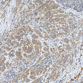 Anti-SNPH Antibody