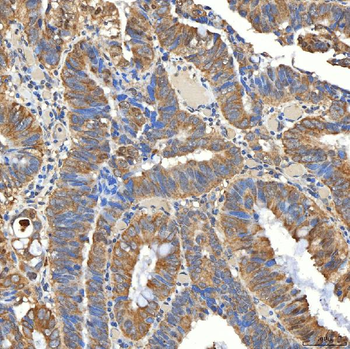 Anti-SNPH Antibody