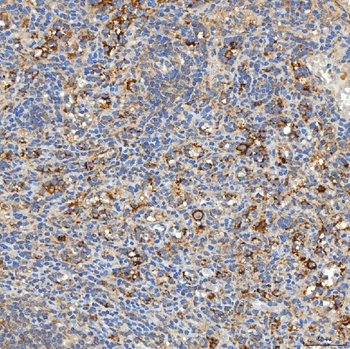 Anti-SNPH Antibody