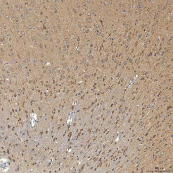 Anti-SNPH Antibody
