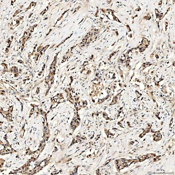 Anti-SMOX Antibody