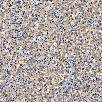 Anti-SMOX Antibody