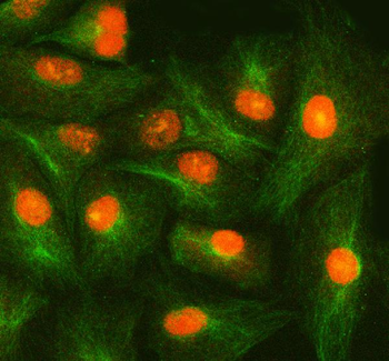 Anti-SMOX Antibody