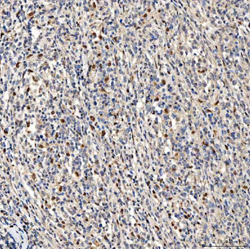 Anti-SMOX Antibody
