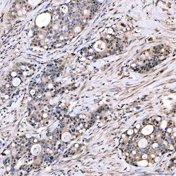 Anti-SMOX Antibody