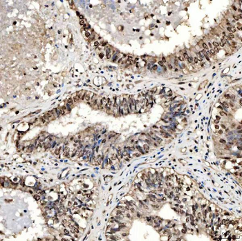 Anti-SMOX Antibody