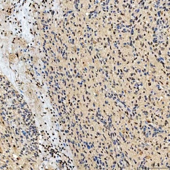 Anti-SMOX Antibody