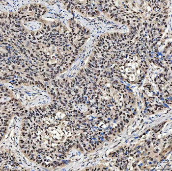 Anti-SMOX Antibody