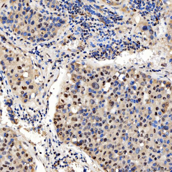 Anti-SMOX Antibody