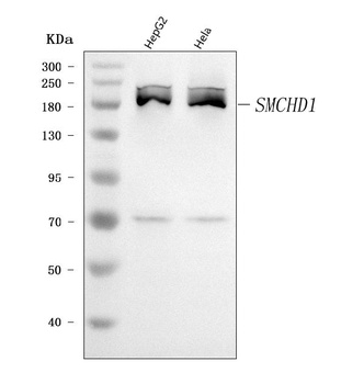 SMCHD1 Antibody