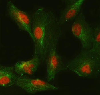 Anti-SMC6 Antibody
