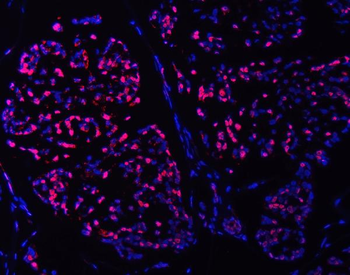 Anti-SMC6 Antibody