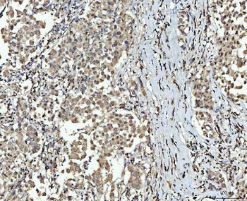 Anti-SMC6 Antibody