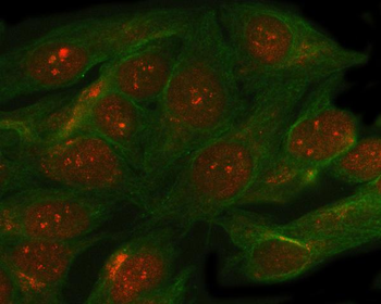 Anti-SMC5 Antibody