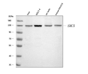Anti-SMC5 Antibody