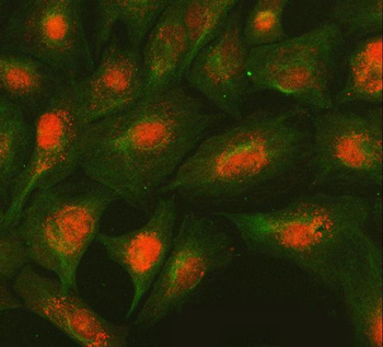 Anti-SMC2 Antibody