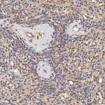 Anti-SNF2H/SMARCA5 Antibody