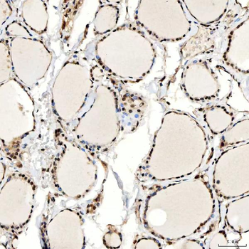 Anti-SNF2H/SMARCA5 Antibody