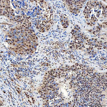 Anti-SNF2H/SMARCA5 Antibody
