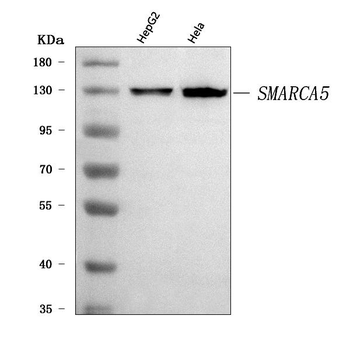Anti-SNF2H/SMARCA5 Antibody