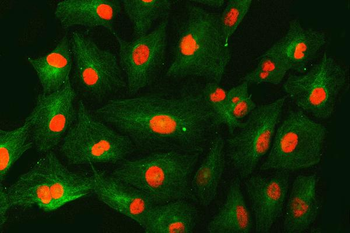 Anti-SNF2H/SMARCA5 Antibody