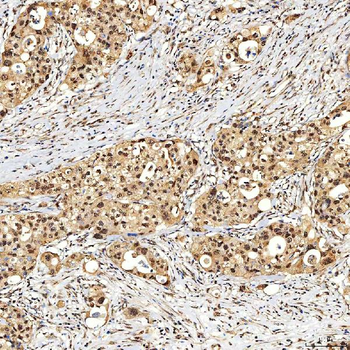Anti-SNF2H/SMARCA5 Antibody
