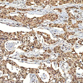 Anti-SNF2H/SMARCA5 Antibody