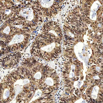 Anti-SNF2H/SMARCA5 Antibody