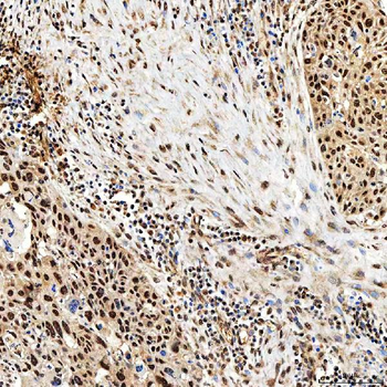 Anti-SNF2H/SMARCA5 Antibody