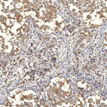 Anti-SNF2H/SMARCA5 Antibody