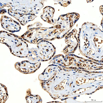 Anti-SNF2H/SMARCA5 Antibody
