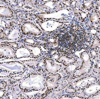 Anti-SMARCA2/BRM Antibody