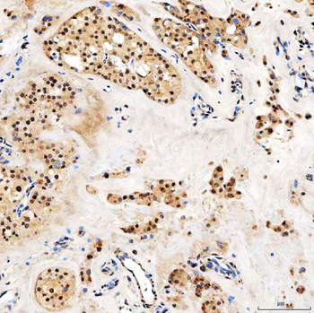 Anti-SMARCA2/BRM Antibody