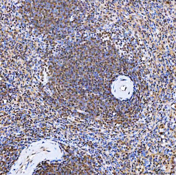 Anti-SMARCA2/BRM Antibody