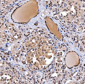Anti-SMARCA2/BRM Antibody