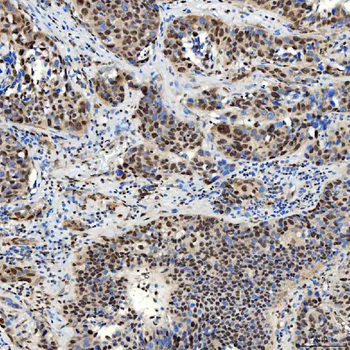 Anti-SMARCA2/BRM Antibody