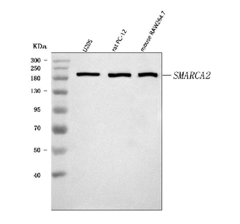Anti-SMARCA2/BRM Antibody