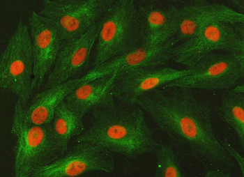 Anti-SMARCA2/BRM Antibody