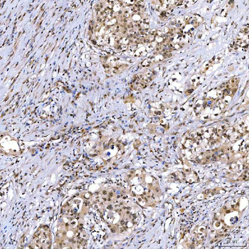 Anti-SMARCA2/BRM Antibody