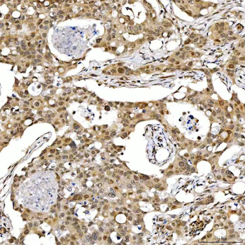 Anti-SMARCA2/BRM Antibody