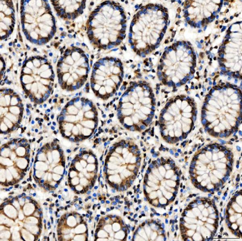 Anti-SMARCA2/BRM Antibody