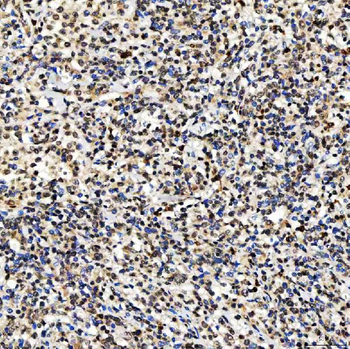 Anti-SMARCA2/BRM Antibody