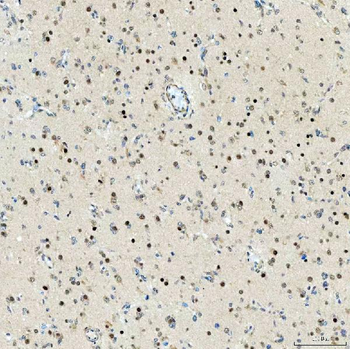 Anti-SMARCA2/BRM Antibody
