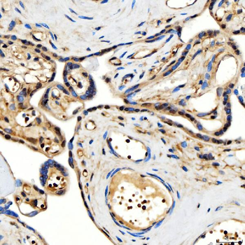 Anti-SMARCA2/BRM Antibody