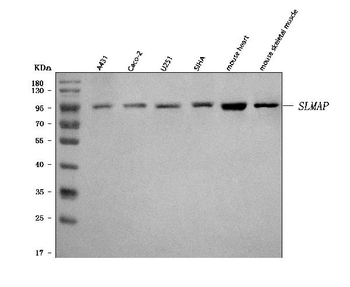 Anti-SLMAP Antibody
